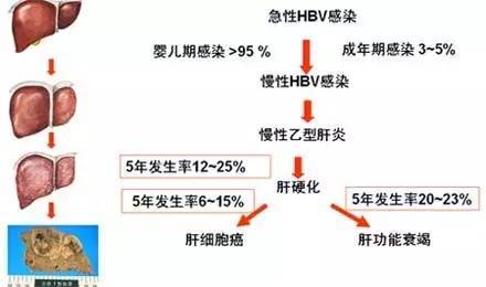 威海肝炎最新动态与情况分析